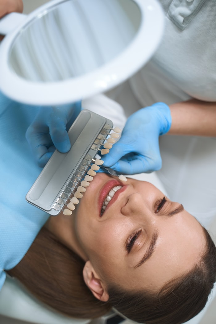 Dentista selecionando a tonalidade de facetas dentárias com a paciente